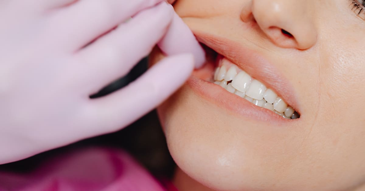 ¿Es necesario usar opioides después de extraer las muelas del juicio? Un estudio reciente sugiere que no