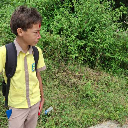 SIN TRANSPORTE: Tres estudiantes de la I.E. Sierra Nevada se accidentaron cuando iban de regreso a casa y la motocicleta resbaló, un joven atravesado por una varilla de hierro de una obra inconclusa