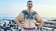 El «Popeye ruso» enfrenta la amputación doble de brazos tras inyectarse vaselina y Synthol