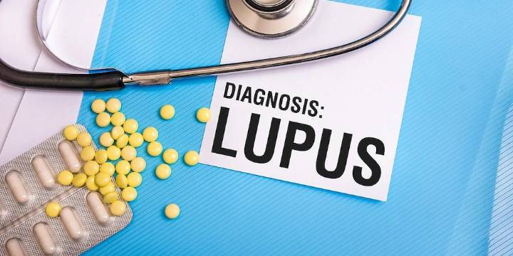 Se revela la causa misteriosa del lupus, dicen los expertos