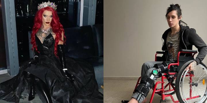Drag Queen comparte en redes su historia tras un accidente en Uber Moto: “No sé si volveré a caminar”