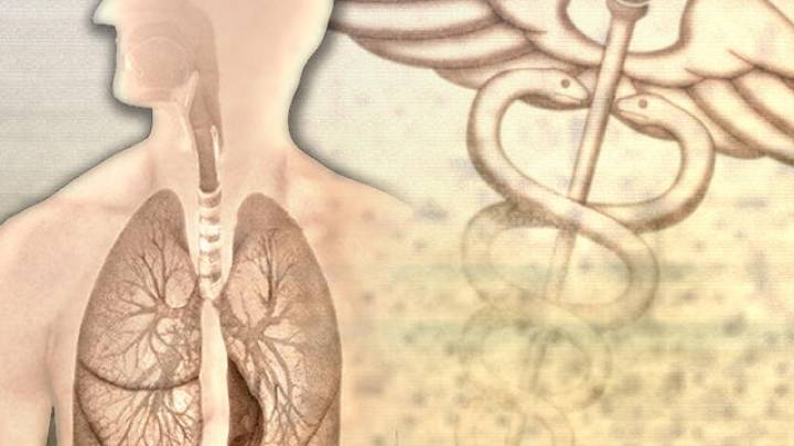 Texas ranks low in key lung cancer metrics, new report finds