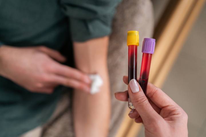 Routine Liquid Biopsies Could Substantially Reduce Late