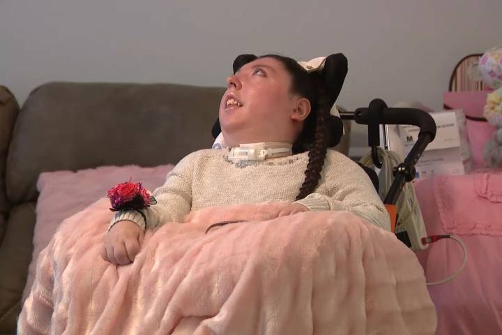 Nebraska Woman Born Without a Brain Turns 20: 'She's a Fighter'