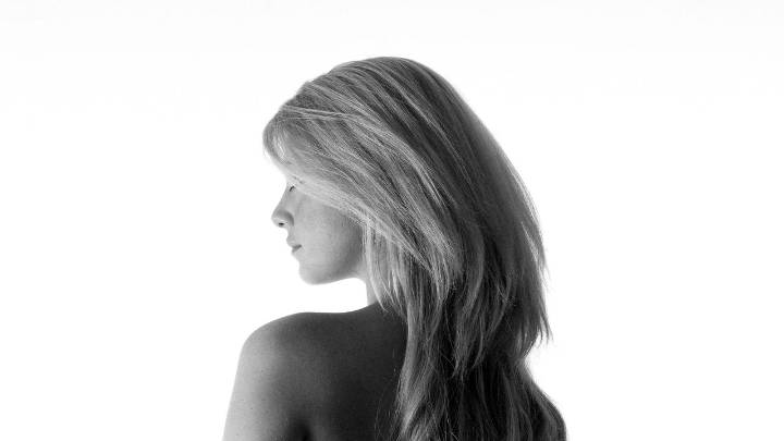 I Got Engaged—And Then Stress Caused Me to Lose My Hair