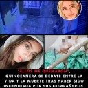 Una Adolescente quemada cruelmente en pasto, justicia para Sara!!!