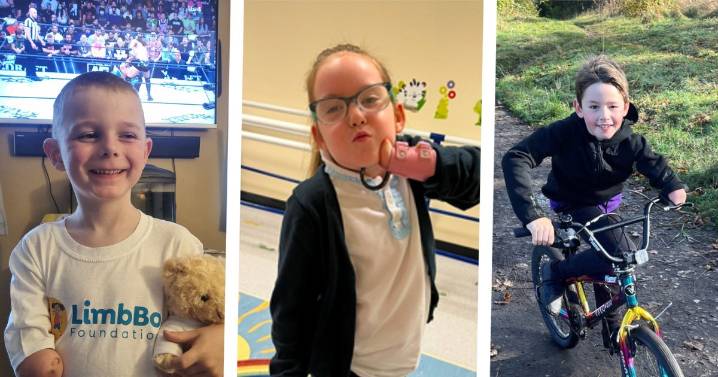 Bionic arms could be a ‘life-changing’ Christmas present for three children in need