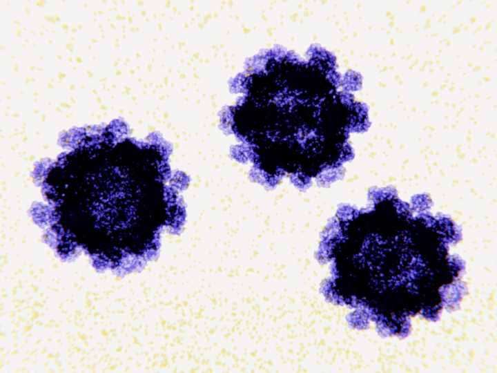 US cases of norovirus on the rise
