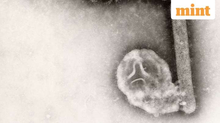 Washington citizen infected with H5N5 bird flu, health experts say ‘only time…’