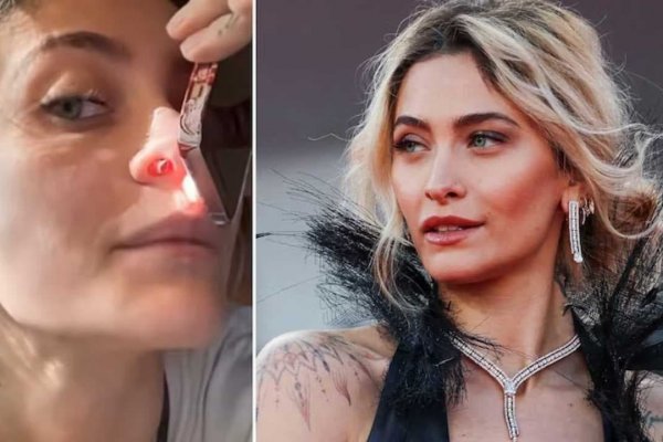 Impresionante video: la hija de Michael Jackson mostró cómo la droga le “comió" la nariz por dentro