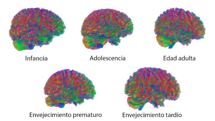 Las cinco ‘edades’ del cerebro humano: hay cambios cruciales alrededor de los 9, los 32, los 66 y los 83 años