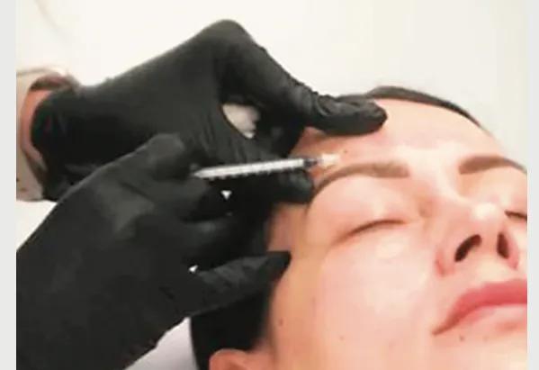 Real-life scars behind reel glow