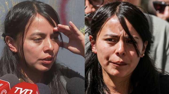 Impactante: Así quedó el rostro de Cristal Aguilera, hermana de Krishna, tras brutal ataque