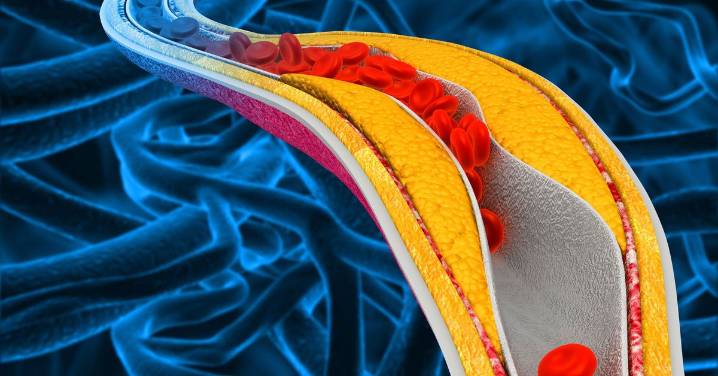 Health news: New Enlicitide pill could be the drug to help those with high cholesterol