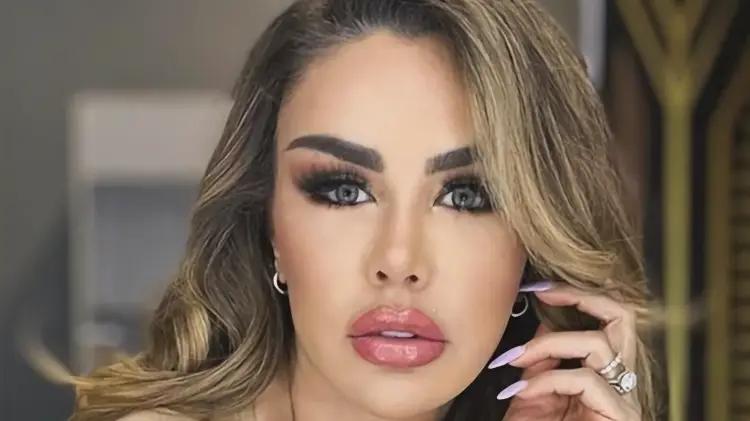 Actriz Ninel Conde sufre cambio de iris por queratopigmentación: polémica de gran presupuesto