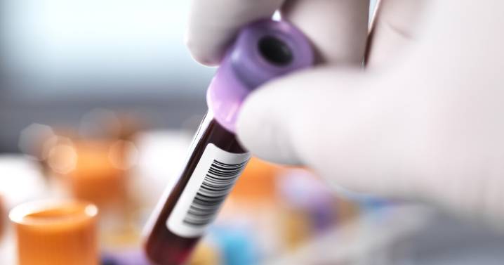 CRISPR gene-editing works to reduce high cholesterol in a new study