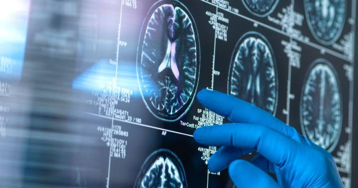 One body shape slows brain ageing and cuts dementia, study shows