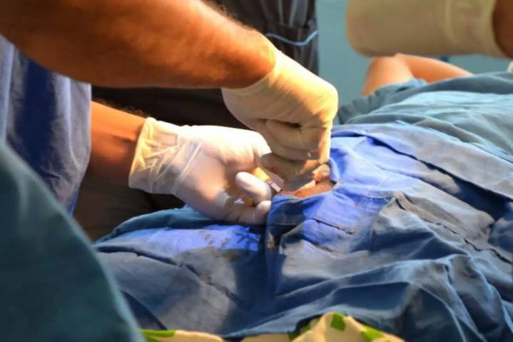 Dónde hacerse la vasectomía gratis en Ica: lista de hospitales del Minsa