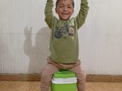 Acondroplasia: el drama de vivir con la forma más común de enanismo y cómo tratarla