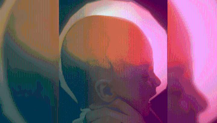 A Woman With Hydranencephaly Just Celebrated Her 20th Birthday. What Does That Mean?