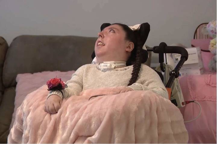 Mujer con hidranencefalia celebra 20 años