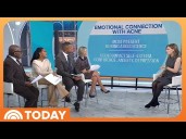 What to Know About Acne: Causes, Remedies, Prevention