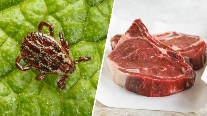 Qué debes saber de la alergia a la carne causada por garrapatas