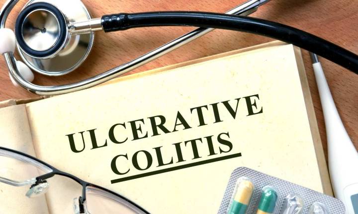 Targeting gut inflammation: Pyruvate's surprising role in colitis relief