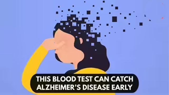 Simple blood test may detect Alzheimer’s risk decades before symptoms: Study