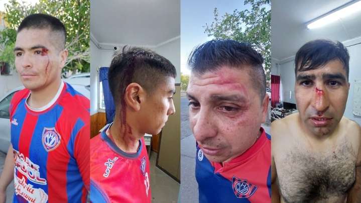 Violencia en el fútbol local: hinchas de Del Bono atacaron a jugadores de Villa Hipódromo