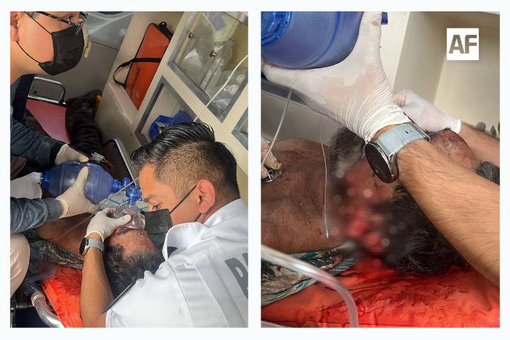 Atienden UMPC de Villa de Álvarez y CRUM atropellamiento de ciclista en el Libramiento Sur de Colima