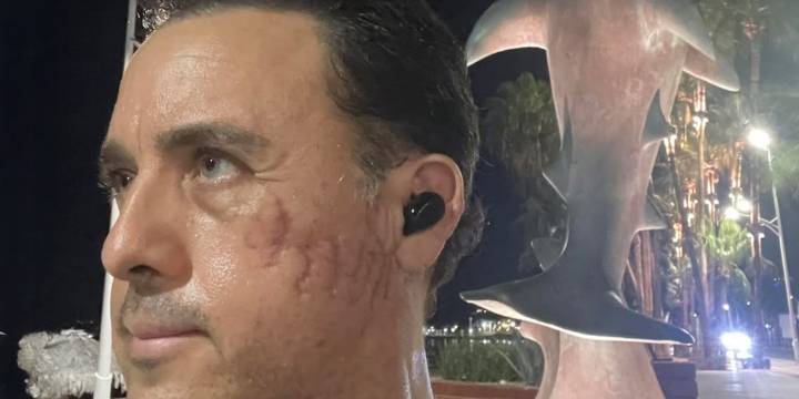 El impactante testimonio del científico mexicano que sobrevivió a un ataque de tiburón: “Sentí la presión de la mordida”