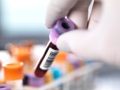 CRISPR gene-editing works to reduce high cholesterol in a new study