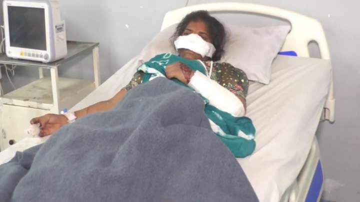 Man cuts wife’s nose over suspicion of infidelity in MP’s Jhabua