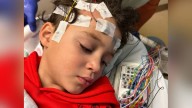 Brain surgery helps 7-year-old become seizure free