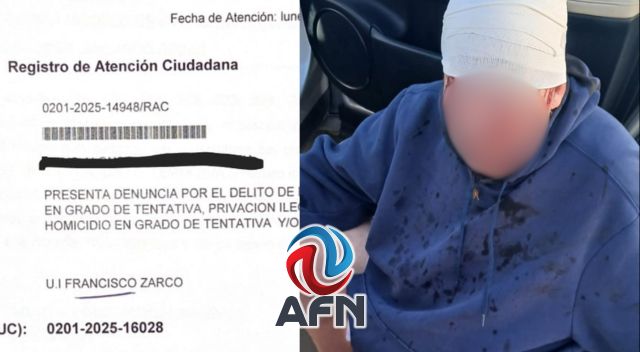 Pareja agredida en la Playa La Misión pide justicia a las autoridades