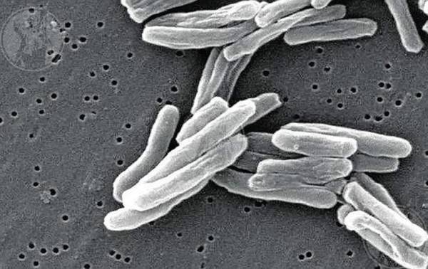 Diagnósticos globales de tuberculosis alcanzan récord