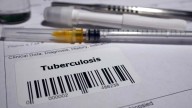 WHO report confirms reduction in TB cases, deaths over 10 yrs: Govt