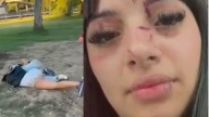 Brutal paliza a una joven influencer de TikTok a la salida de un boliche: la atacaron por "linda"