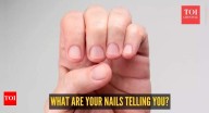 What your fingernails say about your health