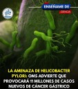 El cáncer de estómago ha registrado un aumento de casos en diversas partes del mundo