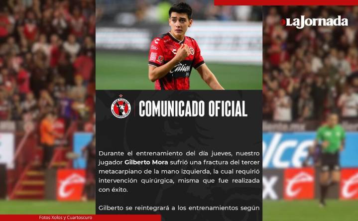 Gilberto Mora sufre fractura en la mano izquierda y es baja de Xolos