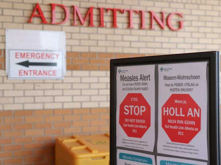 Why has Canada lost its measles-free status – and could the US be next?