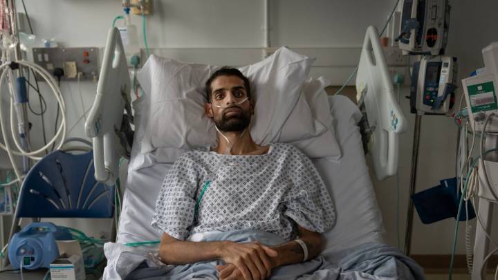 Silicosis from kitchen revamps on rise - as man sent for transplant at 23