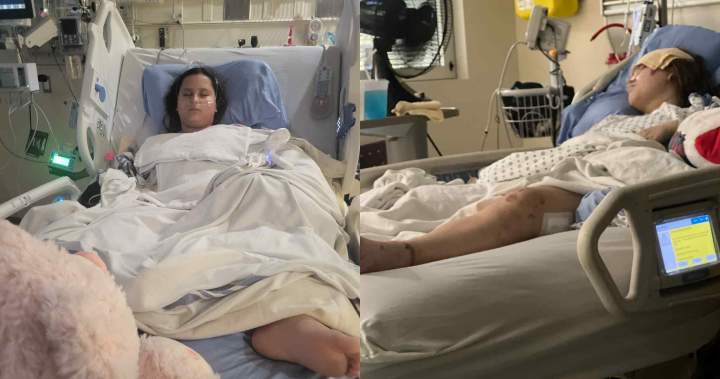 Calgary family wants intersection changes after sisters seriously injured in collision