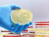 Estudian la función de la metilenomicina A contra superbacterias