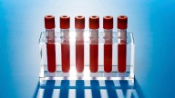'Exciting' New Cancer Blood Test Results Hide a Concerning Problem