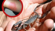 Animales ponzoñosos: alerta en México por picadura de alacrán; reportan 35 casos cada hora