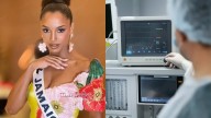 Miss Jamaica sigue en UCI tras su fuerte caída en Miss Universo: piden oraciones por su salud