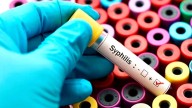 Alerta Sífilis: la provincia de Córdoba encabeza el ranking de crecimiento